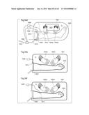 SURGICAL ASSISTING DEVICE diagram and image