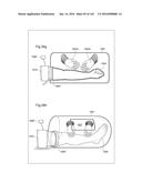 SURGICAL ASSISTING DEVICE diagram and image