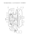 SURGICAL ASSISTING DEVICE diagram and image