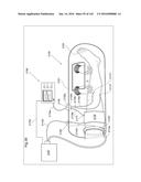 SURGICAL ASSISTING DEVICE diagram and image