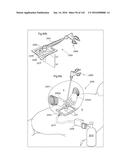 SURGICAL ASSISTING DEVICE diagram and image