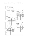 SURGICAL ASSISTING DEVICE diagram and image