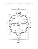 CHEEK AND LIP EXPANSION DEVICE AND METHOD diagram and image