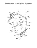 CHEEK AND LIP EXPANSION DEVICE AND METHOD diagram and image