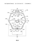 CHEEK AND LIP EXPANSION DEVICE AND METHOD diagram and image