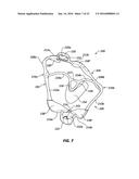 CHEEK AND LIP EXPANSION DEVICE AND METHOD diagram and image