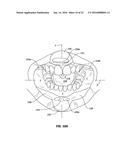 CHEEK AND LIP EXPANSION DEVICE AND METHOD diagram and image