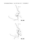 CHEEK AND LIP EXPANSION DEVICE AND METHOD diagram and image