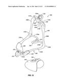 CHEEK AND LIP EXPANSION DEVICE AND METHOD diagram and image