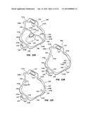 CHEEK AND LIP EXPANSION DEVICE AND METHOD diagram and image