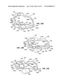 CHEEK AND LIP EXPANSION DEVICE AND METHOD diagram and image