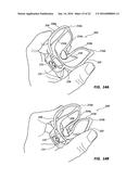 CHEEK AND LIP EXPANSION DEVICE AND METHOD diagram and image