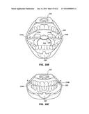 CHEEK AND LIP EXPANSION DEVICE AND METHOD diagram and image