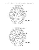 CHEEK AND LIP EXPANSION DEVICE AND METHOD diagram and image