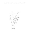 TOOTH MOVEMENT MEASUREMENT BY AUTOMATIC IMPRESSION MATCHING diagram and image