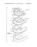 METHOD OF INSTALLING A FINAL DENTAL PROSTHESIS diagram and image