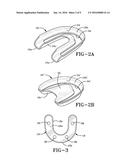 METHOD OF INSTALLING A FINAL DENTAL PROSTHESIS diagram and image