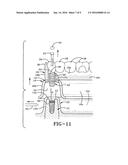 METHOD OF INSTALLING A FINAL DENTAL PROSTHESIS diagram and image