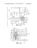 METHOD OF INSTALLING A FINAL DENTAL PROSTHESIS diagram and image