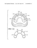 METHOD OF INSTALLING A FINAL DENTAL PROSTHESIS diagram and image