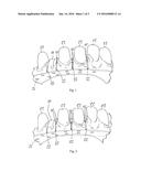 Method for Producing a Distortion-Free Dental Model, and Dental Model so     Produced diagram and image