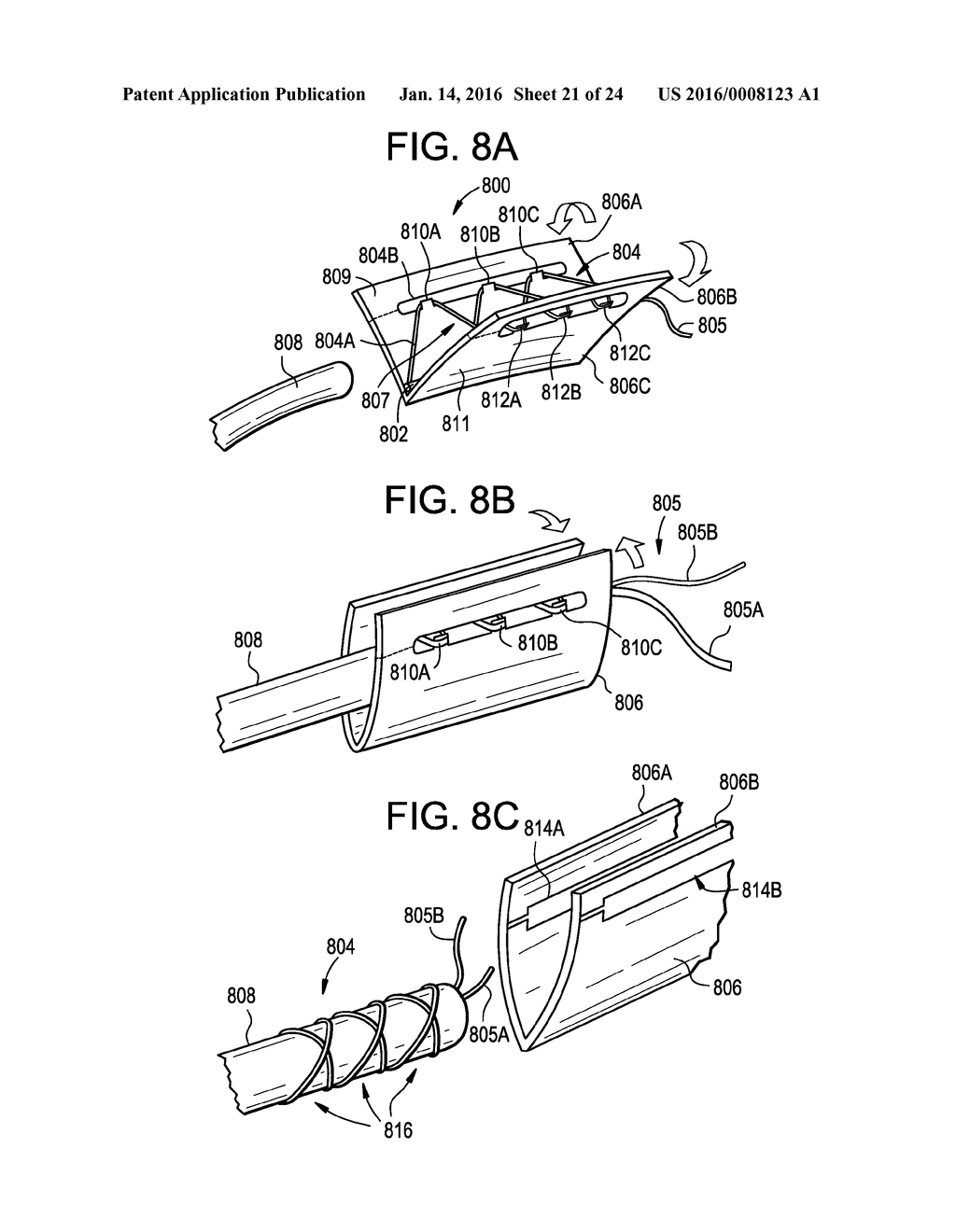 Systems and Methods for Ligament Graft Preparation - diagram, schematic, and image 22