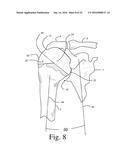 BONE PREPARATION TOOL KIT AND ASSOCIATED METHOD diagram and image