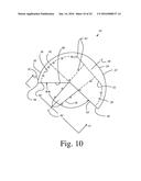 BONE PREPARATION TOOL KIT AND ASSOCIATED METHOD diagram and image