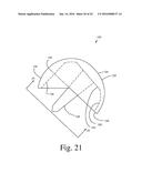 BONE PREPARATION TOOL KIT AND ASSOCIATED METHOD diagram and image