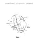 Prosthetic Ankle With Conic Saddle Shaped Joint diagram and image