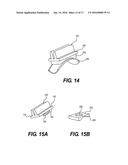 Prosthetic Ankle With Conic Saddle Shaped Joint diagram and image