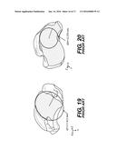 Prosthetic Ankle With Conic Saddle Shaped Joint diagram and image