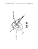 Prosthetic Ankle With Conic Saddle Shaped Joint diagram and image