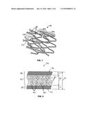 IMPLANTABLE PROSTHESIS WITH RADIOPAQUE PARTICLES AND METHOD OF MAKING SAME diagram and image