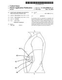 Noninvasive Method and Apparatus for Facilitating Weight Loss diagram and image