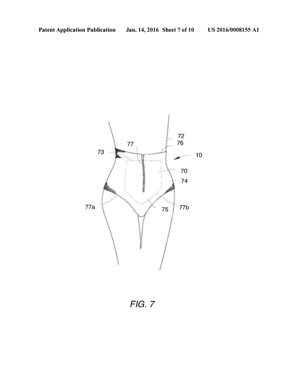 Noninvasive Method and Apparatus for Facilitating Weight Loss - diagram, schematic, and image 08