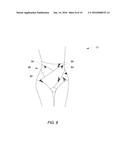 Noninvasive Method and Apparatus for Facilitating Weight Loss diagram and image