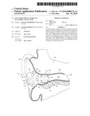 OCCLUSION DEVICE CAPABLE OF OCCLUDING AN EAR CANAL diagram and image