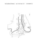 OCCLUSION DEVICE CAPABLE OF OCCLUDING AN EAR CANAL diagram and image