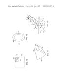 Topical Copper Ion Treatments and Methods of Treatment Using Topical     Copper Ion Treatments in the Oral-Respiratory-Otic Areas of the Body diagram and image