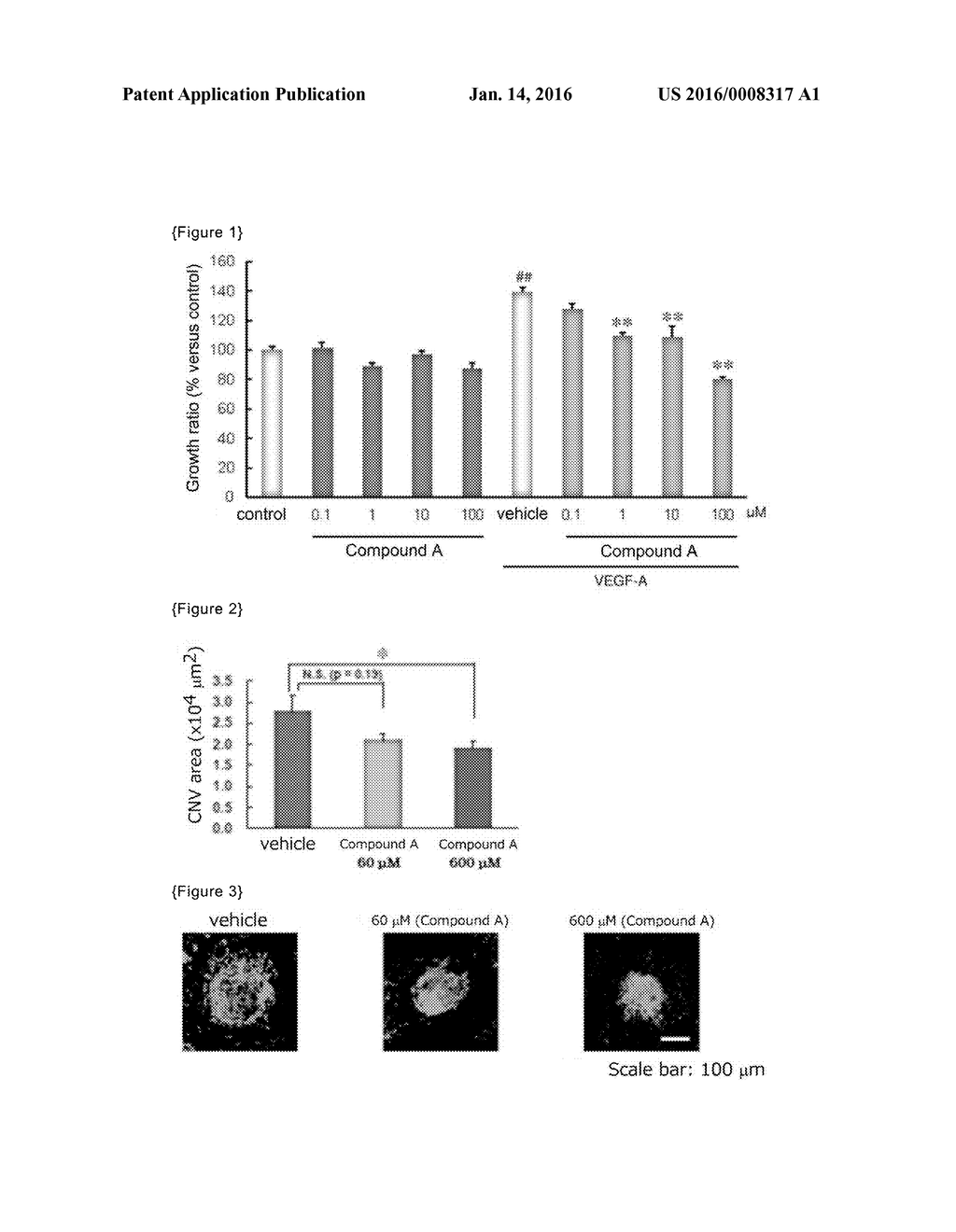 THERAPEUTIC AGENT FOR OCULAR DISEASE - diagram, schematic, and image 02