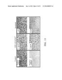 PHARMACEUTICAL COMPOSITIONS FOR INHIBITING ANGIOGENESIS diagram and image