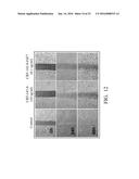 PHARMACEUTICAL COMPOSITIONS FOR INHIBITING ANGIOGENESIS diagram and image