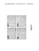 ISCHEMIA/REPERFUSION PROTECTION COMPOSITIONS AND METHODS OF USING diagram and image