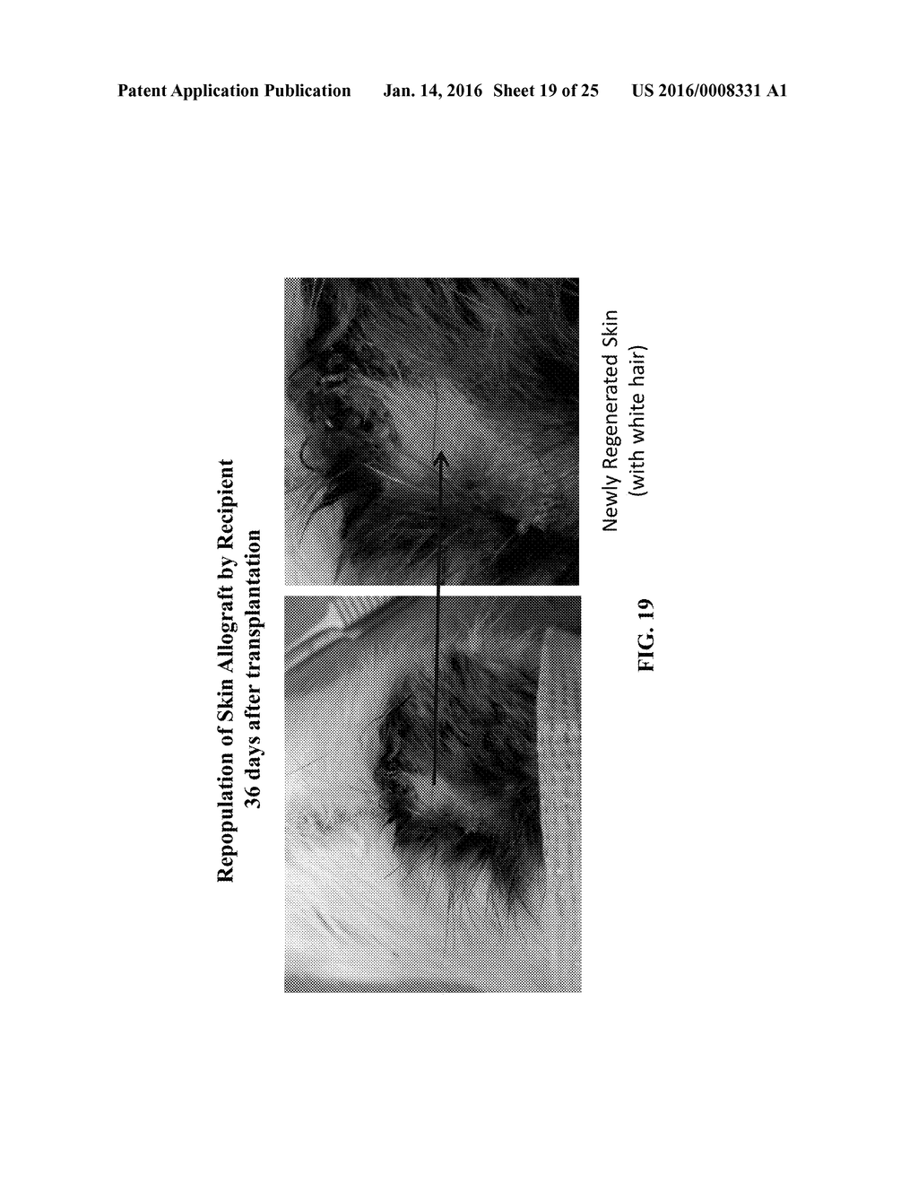 COMPOSITIONS AND METHODS FOR TREATING INFLAMMATORY BOWEL DISEASE - diagram, schematic, and image 20