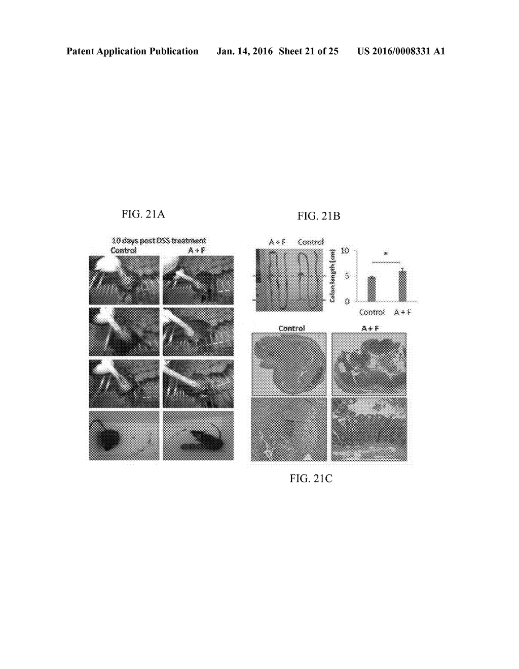 COMPOSITIONS AND METHODS FOR TREATING INFLAMMATORY BOWEL DISEASE - diagram, schematic, and image 22