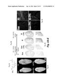 METHODS OF IMPROVING CELL-BASED THERAPY diagram and image