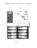 METHODS OF IMPROVING CELL-BASED THERAPY diagram and image