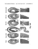 METHODS OF IMPROVING CELL-BASED THERAPY diagram and image