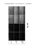 METHODS OF IMPROVING CELL-BASED THERAPY diagram and image